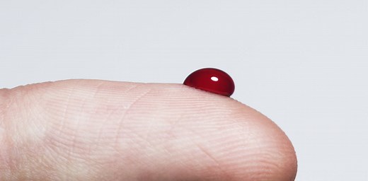 Why do we bleed? A hematologist explains how the body prevents blood loss after injury