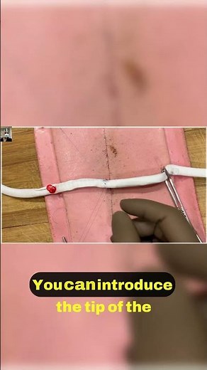 2 Efficient PTFE Graft Techniques Explained 🔍 #vascularsurgery #surgeryfortrainees #drstrangemch