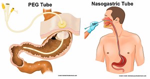 Tube Feeding Nursing Calculations Review