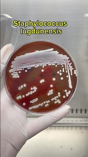 Staphylococcus lugdunensis / Blood agar #visinh #shortvideo #lab #staphylococcus #xuhuong #shorts