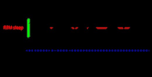 Slow-wave sleep - Wikipedia