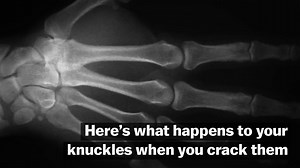 2.7M views · 4.5K shares | Here's what actually happens when your friend — or coworker — cracks their knuckles. | Vox | Facebook