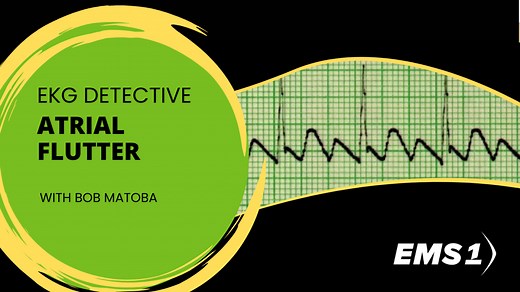 EKG Detective: Atrial flutter