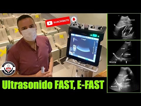 FAST Ultrasound, E-FAST in less than 3 minutes! By Orlando Pérez-Nieto