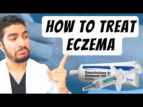 How To Treat Eczema (Dermatologist Explains)