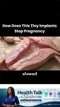 What Birth Control Implants Do Inside Your Body 🚨: How contraceptive work #contraceptives #pregnancy