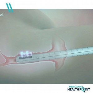 4.8K views | Vaginoplasty (also known as posterior colporrhaphy) is a...