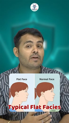 Potter’s Syndrome Explained in Simple Words | Causes, Symptoms & Diagnosis