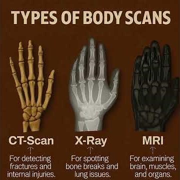 CT Scan vs X-Ray vs MRI: Which Body Scan Saves Lives Faster? 🧠🦴✨ #CTScan #XRay #MRI #ViralVideo