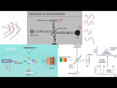 Optical Coherence Tomography (OCT) by Dr. Heba Ibrahim Mansour