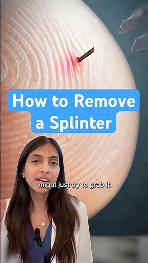 How To Remove a Splinter