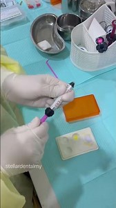 How composite fillings actually work