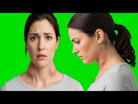 Swollen Cervical Lymph Nodes: Causes And Treatment