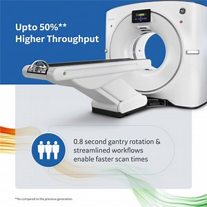 The new Revolution™ Aspire CT delivers extra performance, ensuring higher patient throughput. Featuring an enhanced 3.5 MHU X-ray tube, a powerful 42 kW generator, and efficient heat management, it enables faster scan times and more efficient workflows. | GE HealthCare India