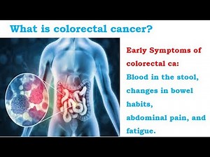 What is colorectal cancer?