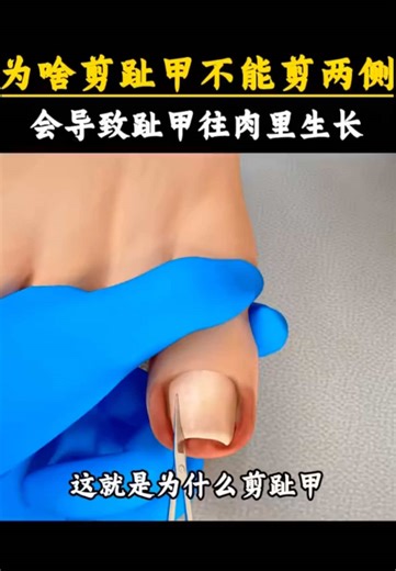 Understanding Horizontal Ridges on Toenails