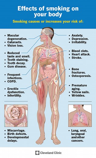 Smoking & Its Effects on Your Body