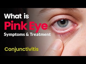 Conjunctivitis: What Is Pink Eye | Symptoms and Treatment