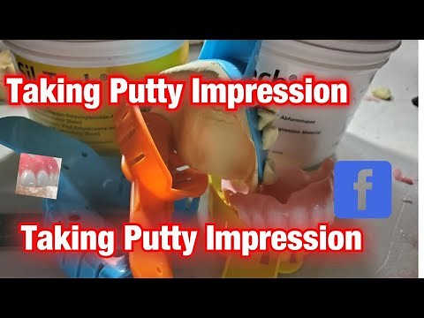Making Putty Impression for Dentures.
