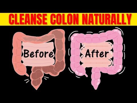 How To Cleanse Your Colon Naturally At Home | Reduce Constipation | Fit&Fab