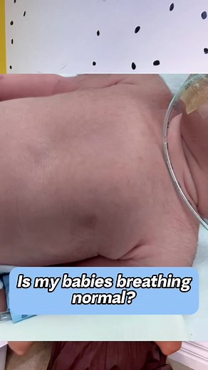 Understanding Periodic Breathing in Newborns