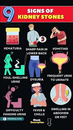 9 Signs of Kidney Stones You Shouldn’t Ignore | How to Know If You Have Kidney Stones