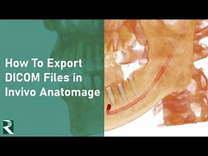 Invivo Anatomage - how to export DICOM files