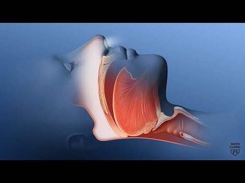 Mayo Clinic Minute: What happens to your body when you have obstructive sleep apnea?