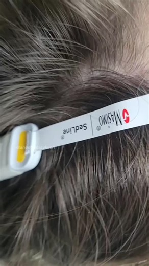 🅿🆁🅰🅳🅷🅰🅿 on Instagram: "SEDLINE Brain Monitor 🧠 by Masimo Monitors sedation depth using EEG brain waves ⚡️. Gives Patient State Index (PSI) 📊: 0️⃣ = deep sleep → 1️⃣0️⃣0️⃣ = fully awake Quick History 📜 Started as PSA4000 by Physiometrix 🏥 Hospira bought (2005) → Masimo (2010) 📈 Now: SEDLine system with forehead sensors ✨ How It Works ⚙️ Uses: 5-electrode sticker (SEDtrace) 🩹 on forehead → 4-channel EEG from both brain sides 🧠🧠 PSI calculates from: EEG power (strength) 💪 Frequency 
