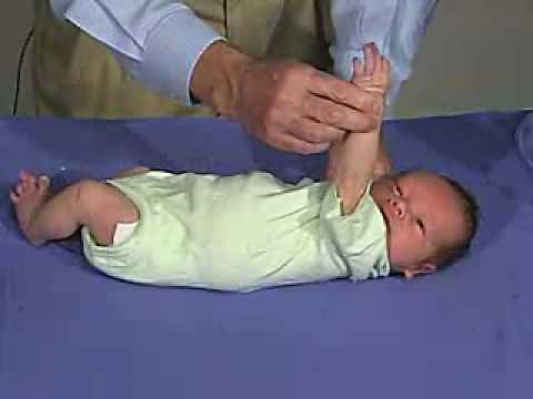 physical exam -Newborn Normal: Tone - Arm Traction