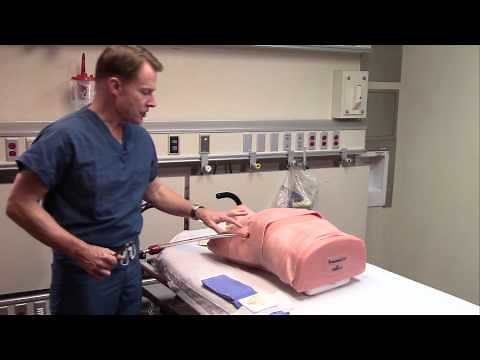 Chest Tube Removal
