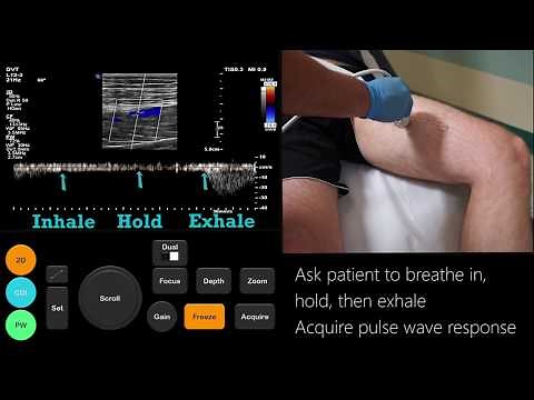 Ultrasound Tutorial: DVT / Lower Limb Veins | Radiology Nation