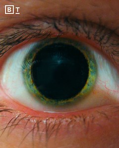 46K views · 1.4K reactions | Psychedelic medicines are surging in popularity. Here’s how they work. | Big Think | Facebook