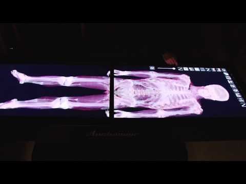 Anatomage Table Demonstration