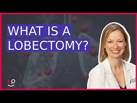 What Is a Lobectomy? Dr. Cassidy on Lung Cancer Removal
