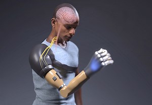 Bionic Arm’s Neurorobotic Sensory-Motor Fusion Restores Natural Behaviors