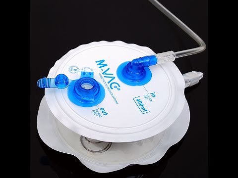 Wound Drainage System M-VAC [HemoVAC]