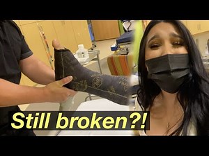 GETTING MY LEG CAST REMOVED!! (SO EXCITED) *MUST WATCH*