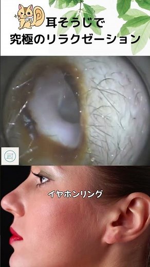 【衝撃】イヤホン愛用者必見！耳垢がリング状になるってホント！？ #耳そうじ #eariss #イヤーエステ
