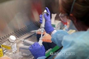 PCR inventor - who died in 2019 - did not say his test won't work for COVID-19 infections