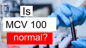 Is MCV 100 normal, high or low? What does Mean corpuscular volume level 100 mean?
