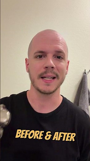 Pitbull Gold Pro | Before & After
