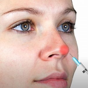 Red nose tip? Could be pressure necrosis complication | Dr Tim Pearce