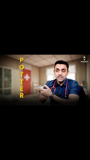 📌 Potter Syndrome in 2 Minutes | High-Yield Pediatrics Dr. Anand explains Potter Syndrome in a quick, high-yield session, covering the top 10 exam points using the mnemonic P-O-T-T-E-R. 🔹 Mnemonic Breakdown: P: Pulmonary hypoplasia O: Oligohydramnios T: Twisted face T: Twisted body (wrinkled skin) E: Extremities defects R: Renal agenesis 💡 Key Exam Tips: Twisted face & body = wrinkled skin Renal agenesis alert: Single umbilical artery → suspect renal agenesis ❓ Question for viewers: Which umb