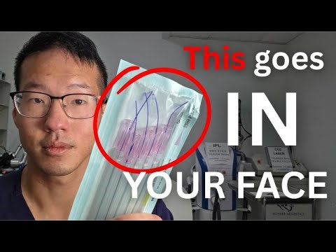This is the REALITY of Thread Face Lifting | FULL TREATMENT VIDEO