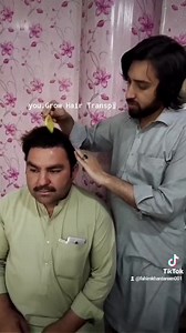 9K views · 153 reactions | One year Live Result WhatsApp 03349004048 | Grow Hair Transplant & Dental Centre | Facebook
