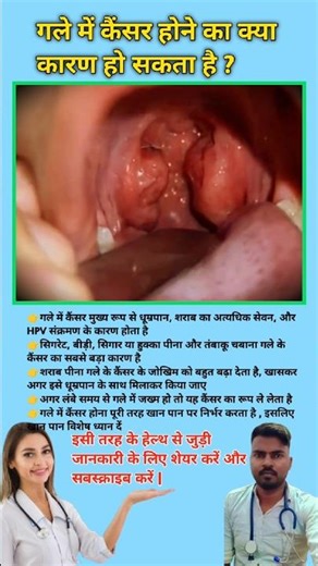 गले में कैंसर होने का क्या कारण हो सकता है ? Reason for Mouth Cancer || #viral #mouthcancer