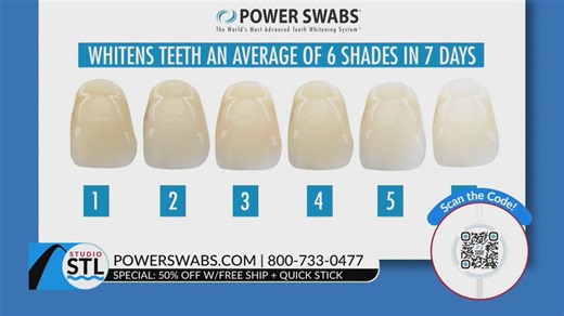Enjoy 50% off teeth whitening with free shop from Power Swabs