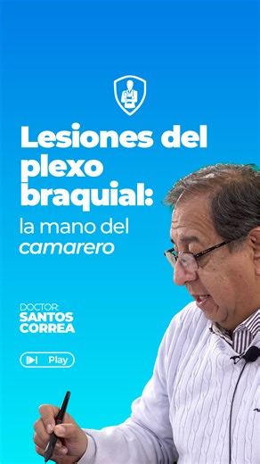 El doctor Santos Correa nos habla sobre como ciertas lesiones en el plexo braquial pueden reconocerse clínicamente por la forma característica de la mano. Cuando se lesionan los nervios C5 y C6, aparece la llamada “mano del camarero” o mano en propina disimulada, típica de la afectación del tronco superior. En cambio, cuando se compromete el tronco inferior (unión de C8 y T1), puede producirse otra lesión, muchas veces asociada al parto o a traumatismos con gran separación entre el tronco y el m