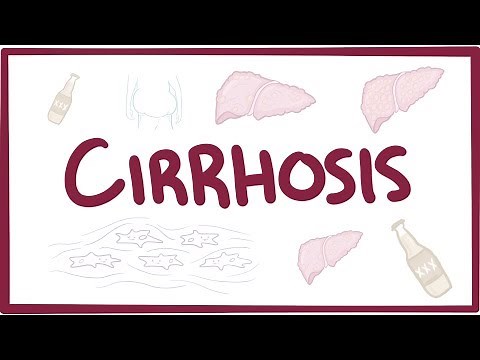 Cirrhosis - causes, symptoms, diagnosis, treatment, pathology